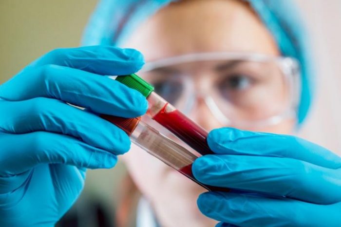 Διαθέσιμη εντός του 2022 εξέταση αίματος που ανιχνεύει τον καρκίνο