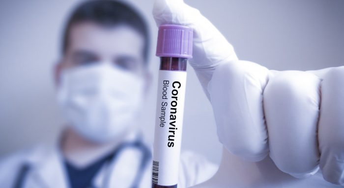 Κορυφαία Ελληνίδα λοιμωξιολόγος του Cambridge: Είμαστε κοντά σε θεραπεία για τον κορωνοϊό