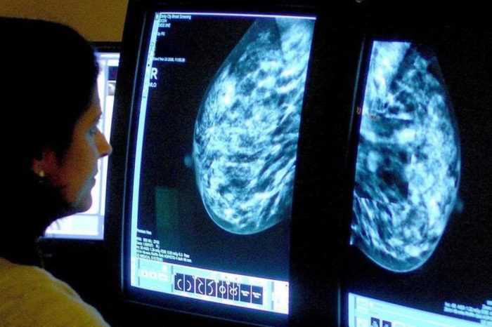 Καρκίνος του μαστού: Επιστήμονες ανέπτυξαν γρήγορο τεστ αίματος με 100% ακρίβεια
